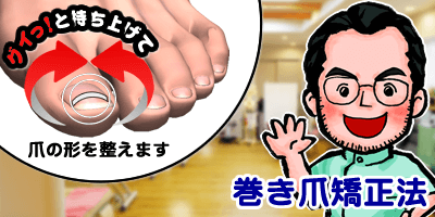 ハイレベル巻き爪矯正法