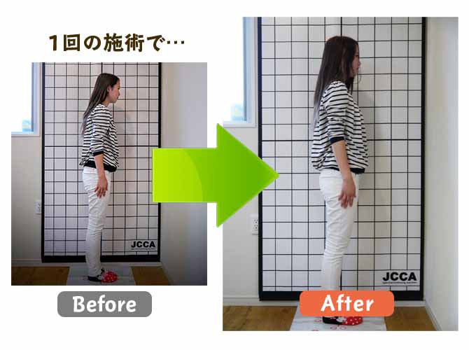 1回の施術でビフォーアフター